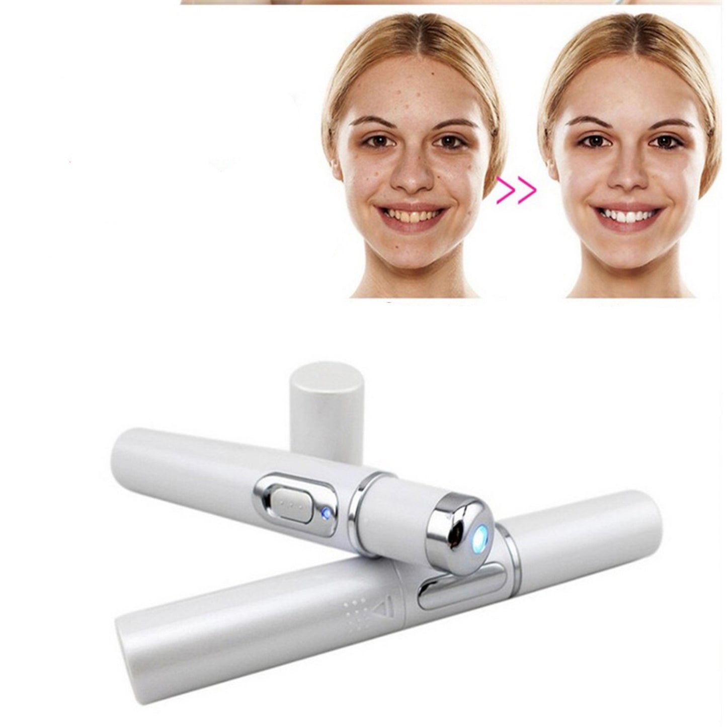 Stylo de thérapie à la lumière bleue contre l'acné, élimination au Laser, traitement des rides et des cicatrices, dispositif souple